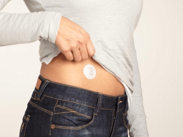 i-Port Advance™ Injektionsport, 10 Stk.